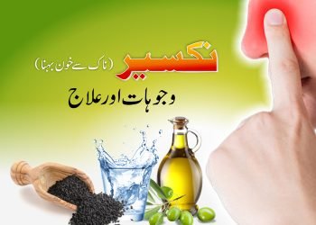 (epistaxis treatment) nakseer- ilaaj aur wajohaat-nosebleed