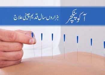 آکو پنکچر: قدیم طریقہ علاج