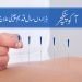 آکو پنکچر: قدیم طریقہ علاج